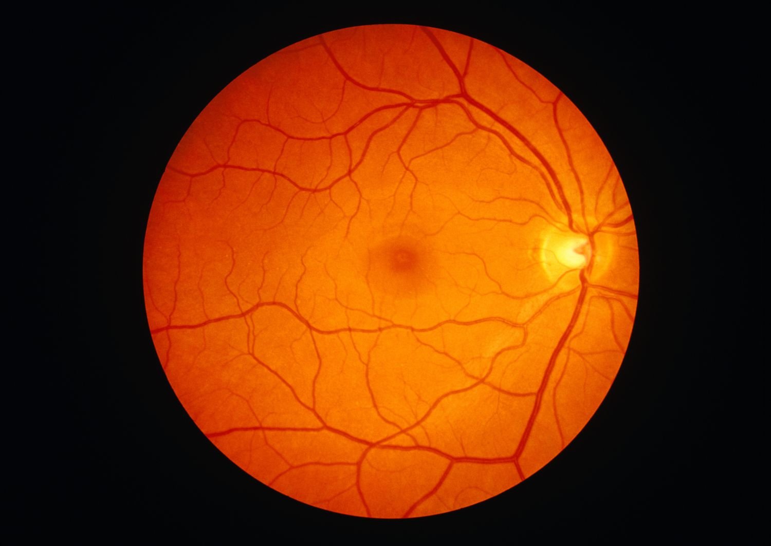 retina
